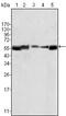 LYN Proto-Oncogene, Src Family Tyrosine Kinase antibody, MA5-15329, Invitrogen Antibodies, Western Blot image 