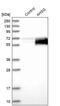 Alpha 2-HS Glycoprotein antibody, PA5-51594, Invitrogen Antibodies, Western Blot image 