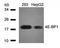 Eukaryotic Translation Initiation Factor 4E Binding Protein 1 antibody, orb14606, Biorbyt, Western Blot image 
