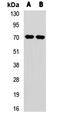Carnitine O-Octanoyltransferase antibody, orb412311, Biorbyt, Western Blot image 