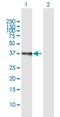 ETS translocation variant 2 antibody, H00002116-B01P, Novus Biologicals, Western Blot image 