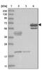 Asparagine Synthetase Domain Containing 1 antibody, PA5-57535, Invitrogen Antibodies, Western Blot image 