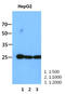 RAS Like Proto-Oncogene A antibody, LS-C200832, Lifespan Biosciences, Western Blot image 