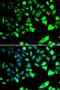 X-Linked Inhibitor Of Apoptosis antibody, LS-C748335, Lifespan Biosciences, Immunofluorescence image 
