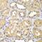 Ketohexokinase antibody, GTX33283, GeneTex, Immunohistochemistry paraffin image 