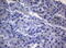 RAB3A, Member RAS Oncogene Family antibody, M03463-1, Boster Biological Technology, Immunohistochemistry paraffin image 