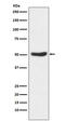 Glycogen Synthase Kinase 3 Alpha antibody, M03152-1, Boster Biological Technology, Western Blot image 