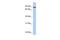 Junctophilin 1 antibody, GTX46050, GeneTex, Western Blot image 