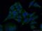 SHC Adaptor Protein 1 antibody, 10054-1-AP, Proteintech Group, Immunofluorescence image 