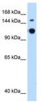 GTPase Activating Protein And VPS9 Domains 1 antibody, TA344118, Origene, Western Blot image 