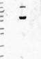 Dipeptidyl Peptidase Like 10 antibody, NBP2-13936, Novus Biologicals, Western Blot image 