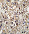 Cytochrome P450 Family 2 Subfamily C Member 9 antibody, abx033742, Abbexa, Immunohistochemistry frozen image 