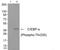 CCAAT Enhancer Binding Protein Alpha antibody, GTX55349, GeneTex, Western Blot image 