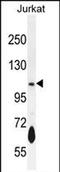 Phosphodiesterase 3B antibody, PA5-71620, Invitrogen Antibodies, Western Blot image 