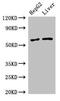 Solute Carrier Family 2 Member 9 antibody, CSB-PA873638LA01HU, Cusabio, Western Blot image 
