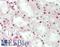 Nuclear Receptor Subfamily 3 Group C Member 1 antibody, LS-B13318, Lifespan Biosciences, Immunohistochemistry paraffin image 