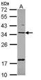 Thioredoxin Related Transmembrane Protein 1 antibody, GTX108081, GeneTex, Western Blot image 