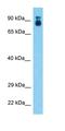 Coiled-Coil Serine Rich Protein 1 antibody, orb326065, Biorbyt, Western Blot image 