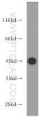Ubiquinol-Cytochrome C Reductase Core Protein 1 antibody, 21705-1-AP, Proteintech Group, Western Blot image 