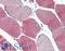 Lipoprotein Lipase antibody, LS-B15018, Lifespan Biosciences, Immunohistochemistry paraffin image 