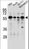 Forkhead box protein C2 antibody, LS-C166217, Lifespan Biosciences, Western Blot image 