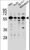 Forkhead Box C2 antibody, LS-C166217, Lifespan Biosciences, Western Blot image 