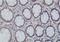 Spastin antibody, H00006683-M02, Novus Biologicals, Immunohistochemistry frozen image 