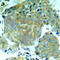 Eukaryotic Translation Initiation Factor 2 Subunit Alpha antibody, AP0342, ABclonal Technology, Immunohistochemistry paraffin image 