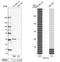 Actin Related Protein 2/3 Complex Subunit 1B antibody, NBP1-90114, Novus Biologicals, Western Blot image 