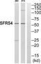Serine And Arginine Rich Splicing Factor 4 antibody, TA314522, Origene, Western Blot image 