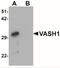 Vasohibin 1 antibody, NBP1-76579, Novus Biologicals, Western Blot image 