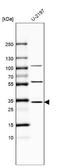 Monoglyceride Lipase antibody, NBP1-89645, Novus Biologicals, Western Blot image 