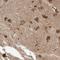 Ubiquitin Conjugating Enzyme E2 K antibody, NBP1-91987, Novus Biologicals, Immunohistochemistry frozen image 