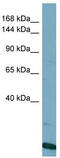 VPS8 Subunit Of CORVET Complex antibody, TA329853, Origene, Western Blot image 