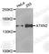 Ataxin 2 antibody, A5902, ABclonal Technology, Western Blot image 
