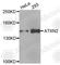 Sca2 antibody, A5902, ABclonal Technology, Western Blot image 