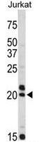 Vasoactive Intestinal Peptide antibody, GTX81846, GeneTex, Western Blot image 