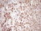 Peripherin antibody, LS-C339864, Lifespan Biosciences, Immunohistochemistry frozen image 