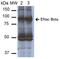 Sodium Channel Epithelial 1 Beta Subunit antibody, orb383782, Biorbyt, Western Blot image 