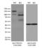 Collagen Type VI Alpha 1 Chain antibody, LS-C796245, Lifespan Biosciences, Western Blot image 