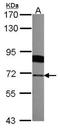 Radixin antibody, NBP1-31553, Novus Biologicals, Western Blot image 