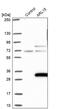 ADP Ribosylation Factor Like GTPase 15 antibody, PA5-60774, Invitrogen Antibodies, Western Blot image 