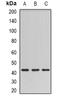 Sulfotransferase Family 2B Member 1 antibody, orb341342, Biorbyt, Western Blot image 