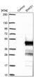Uncharacterized protein C16orf48 antibody, PA5-59460, Invitrogen Antibodies, Western Blot image 