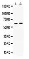 Secretin Receptor antibody, PA5-79960, Invitrogen Antibodies, Western Blot image 
