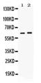 Secretin Receptor antibody, PA5-79960, Invitrogen Antibodies, Western Blot image 