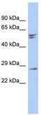 Retinal Degeneration 3, GUCY2D Regulator antibody, TA333379, Origene, Western Blot image 
