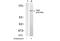 Tyrosine Kinase 2 antibody, AP08010PU-N, Origene, Western Blot image 