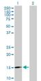 Aspartyl Aminopeptidase antibody, H00023549-D01P, Novus Biologicals, Western Blot image 