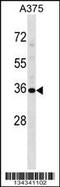 Ubiquitin carboxyl-terminal hydrolase 12 antibody, 58-115, ProSci, Western Blot image 